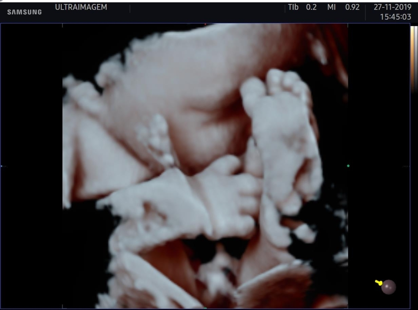 Ultrassom 3D / 4D - imagem 4
