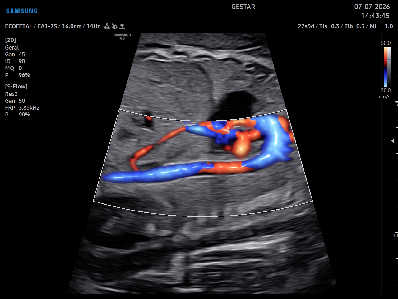 Ultrassom Obstétrico com Doppler