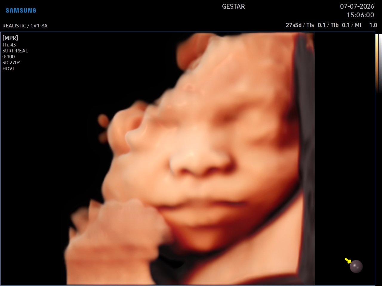 Ultrassom 3D / 4D - imagem 2