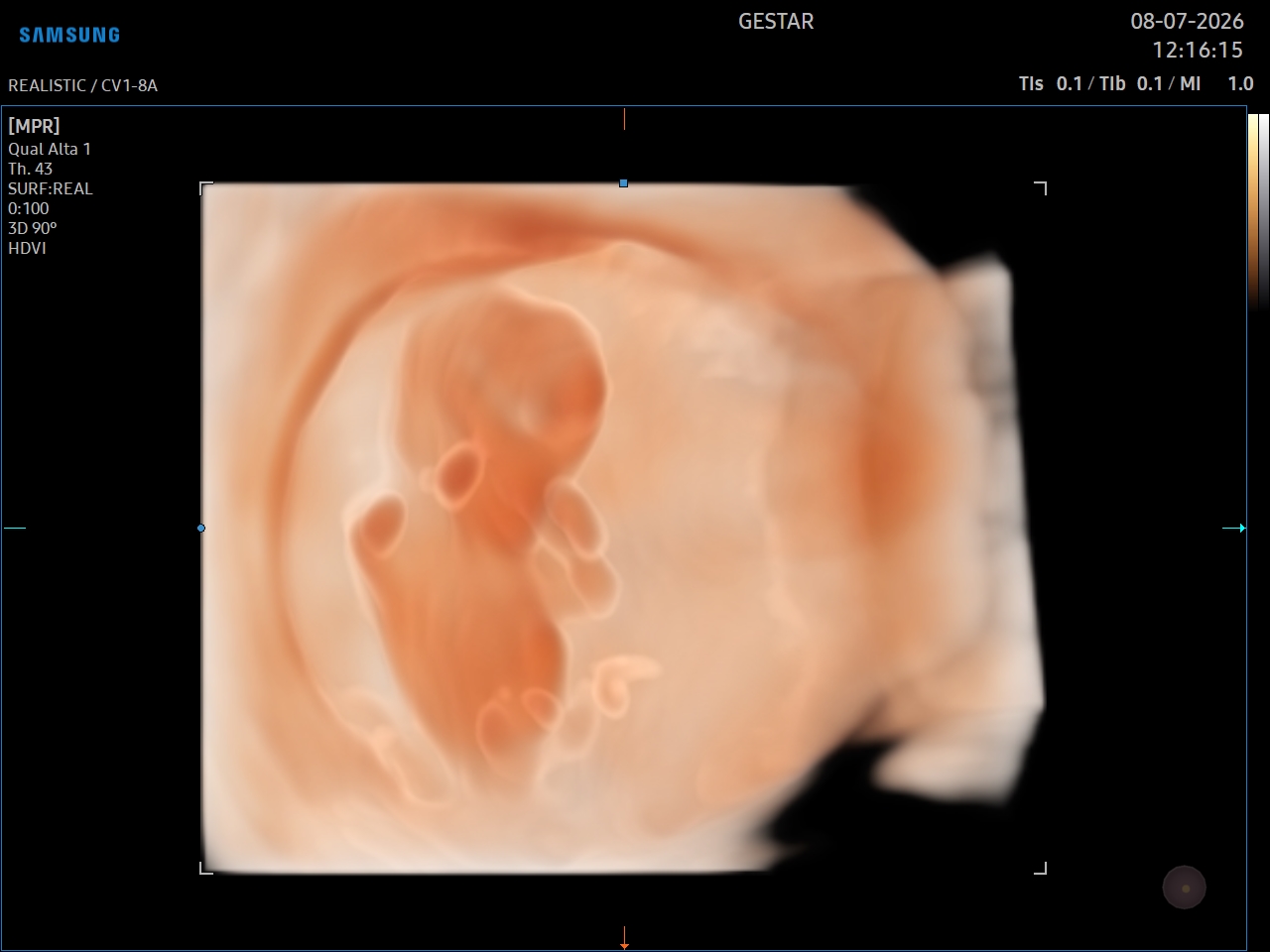Ultrassom 3D / 4D - imagem 1