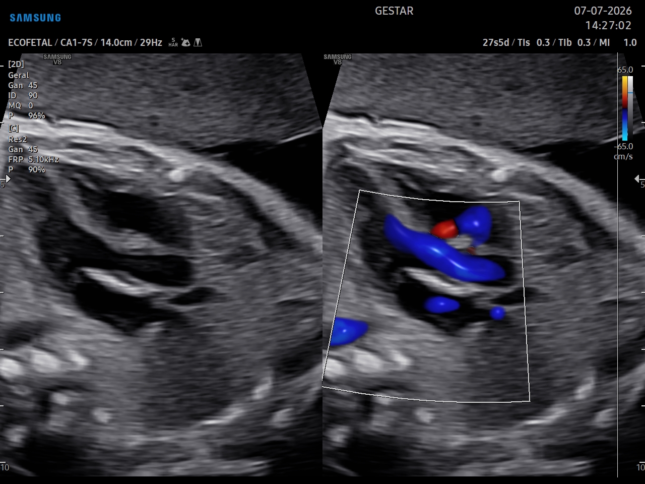 Ultrassom Obstétrico com Doppler - imagem 1