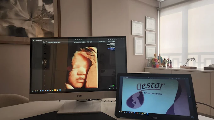 Equipamento de ultrassonografia de alta precisão