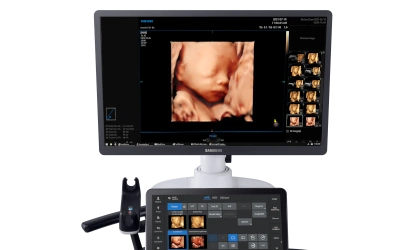 Aparelho de ultrassom moderno utilizado na clínica Gestar