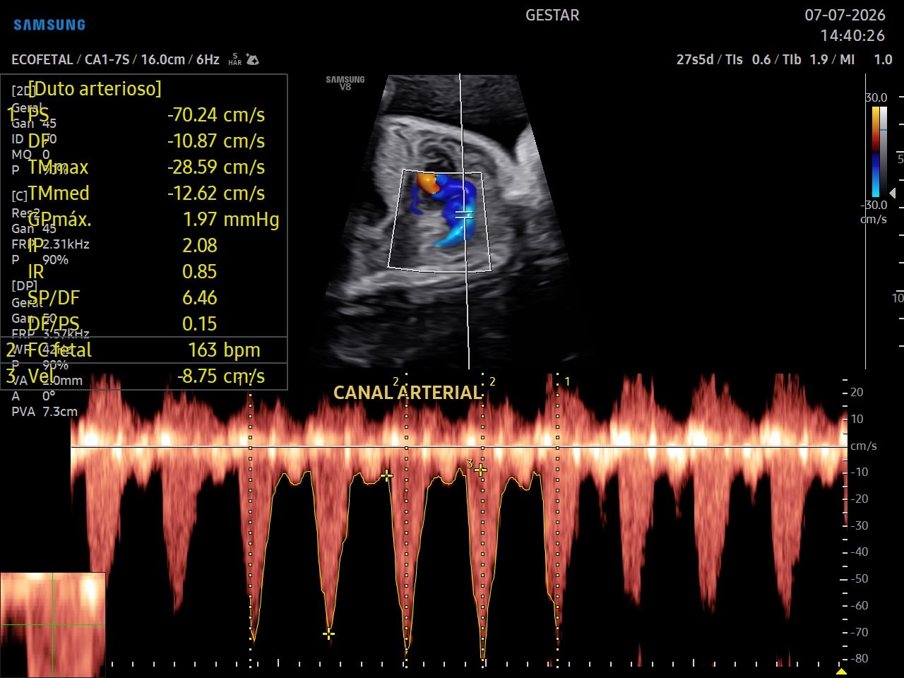 Ultrassom Obstétrico com Doppler - imagem 3