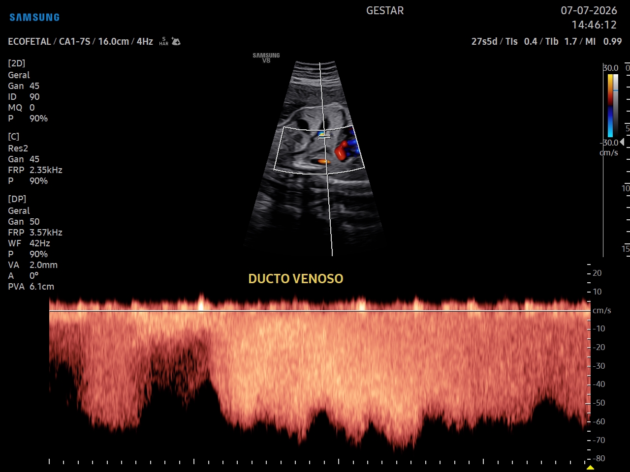 Ultrassom Obstétrico com Doppler - imagem 4