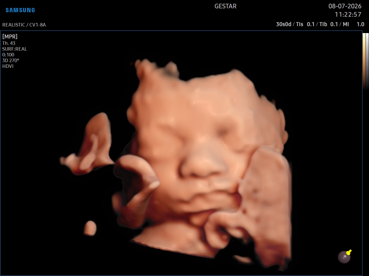 Ultrassom 3D / 4D - imagem 3