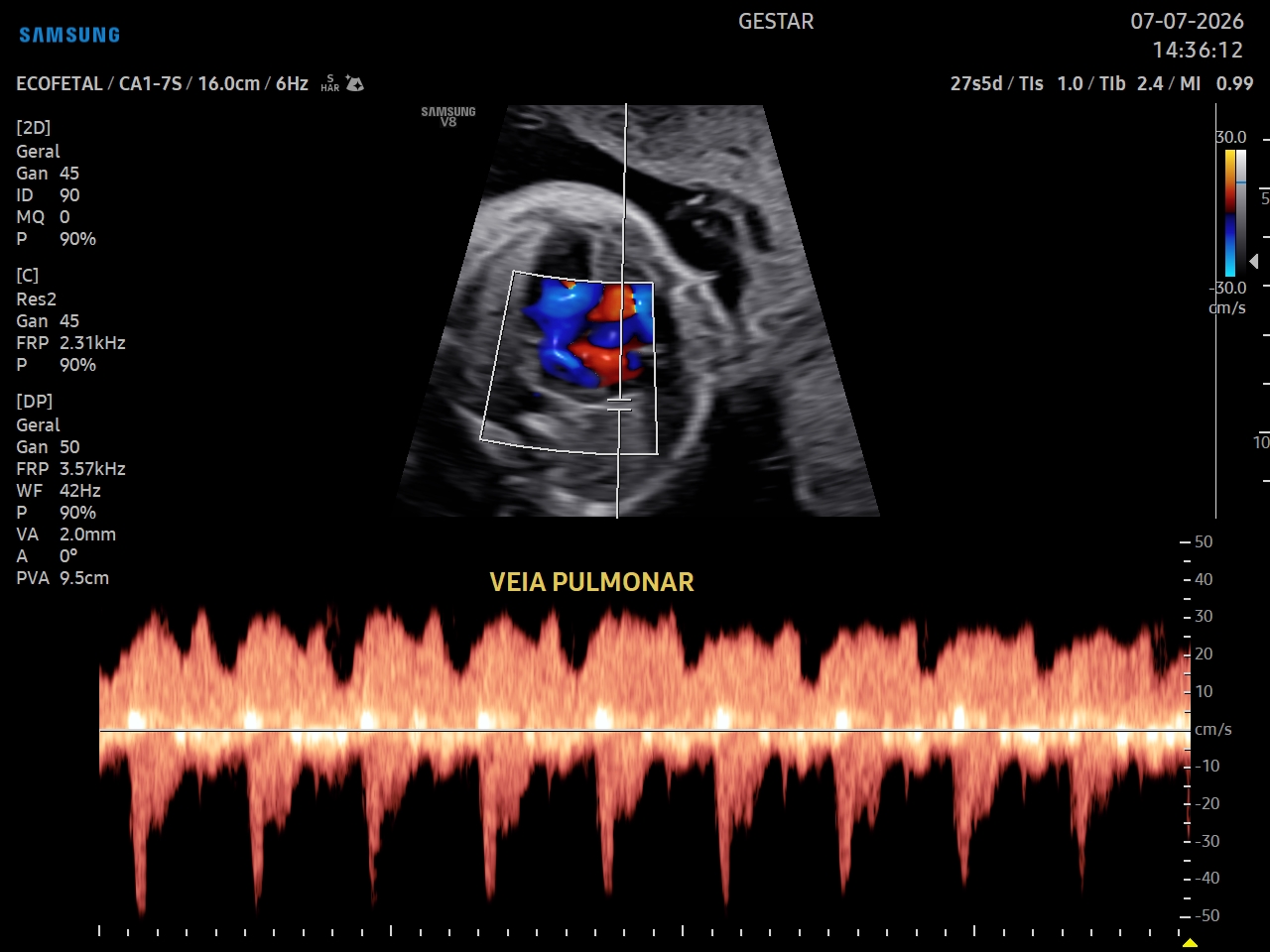 Ultrassom Obstétrico com Doppler - imagem 2